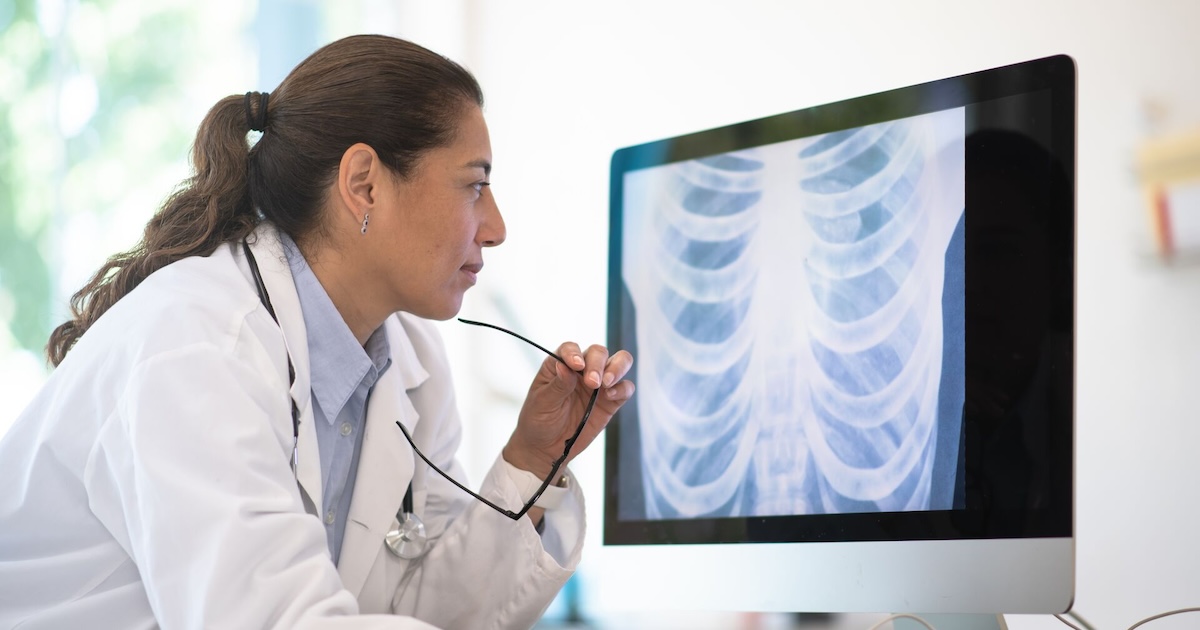 
  A doctor assessing a chest X-ray scan
