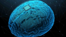 
  Digital image of a brain with a brain-computer interface on it
