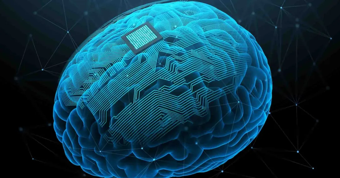 
  Digital image of a brain with a brain-computer interface on it
